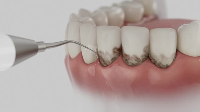 Reliable Dental contractor in Frankton, IN by Dentist Open Now